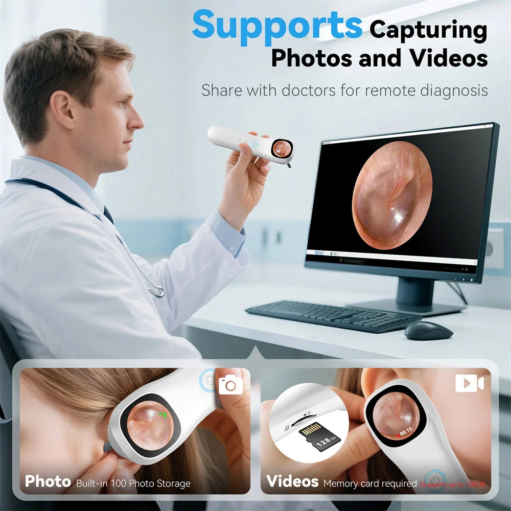 INSKAM Smart Ear Inspection Camera with Screen