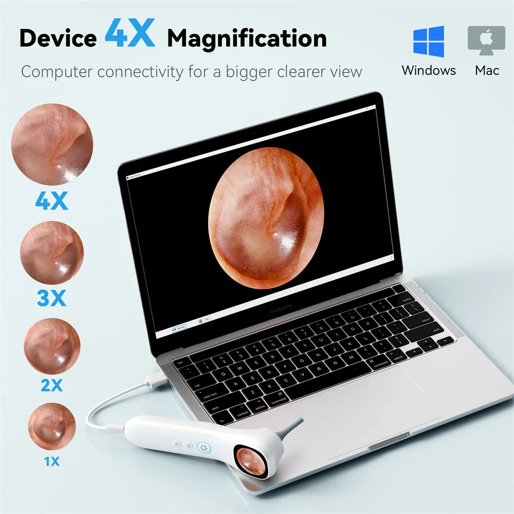 INSKAM Smart Ear Inspection Camera with Screen