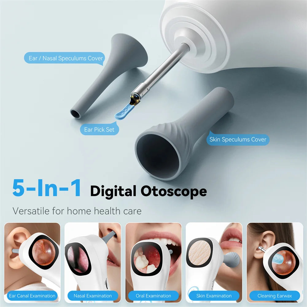 INSKAM Smart Ear Inspection Camera with Screen